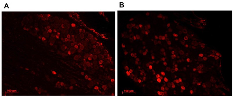 TLR4 expression in DRG neurons.jpg